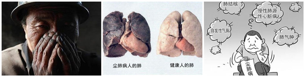 尘肺病的影响